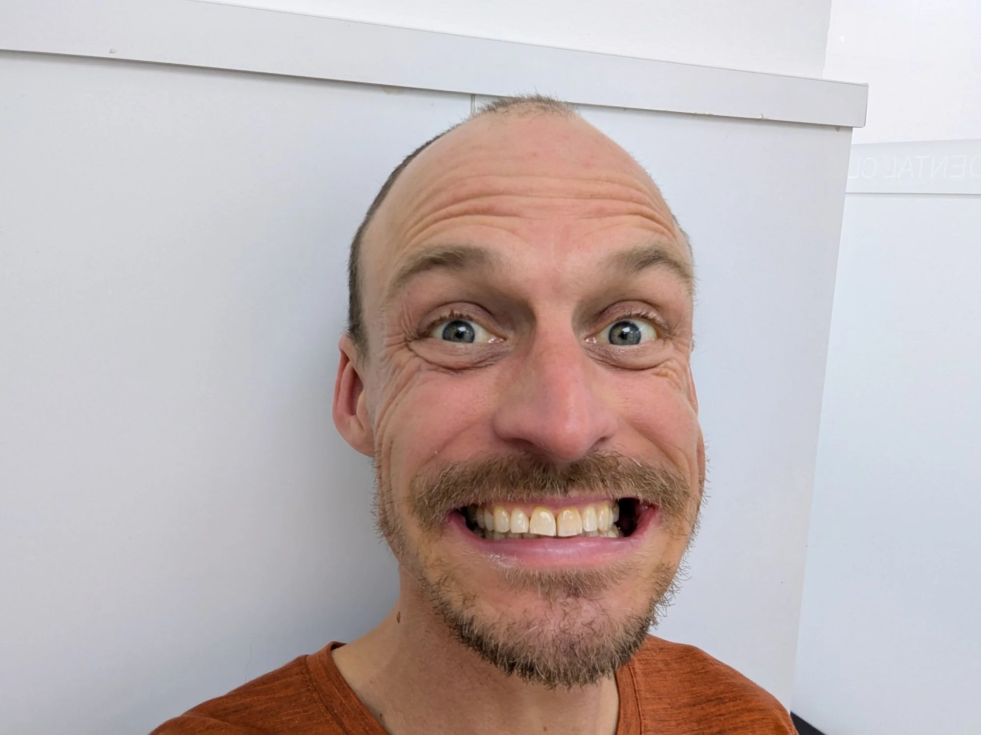 After cleaning Rosinante, I had my teeth cleaned.