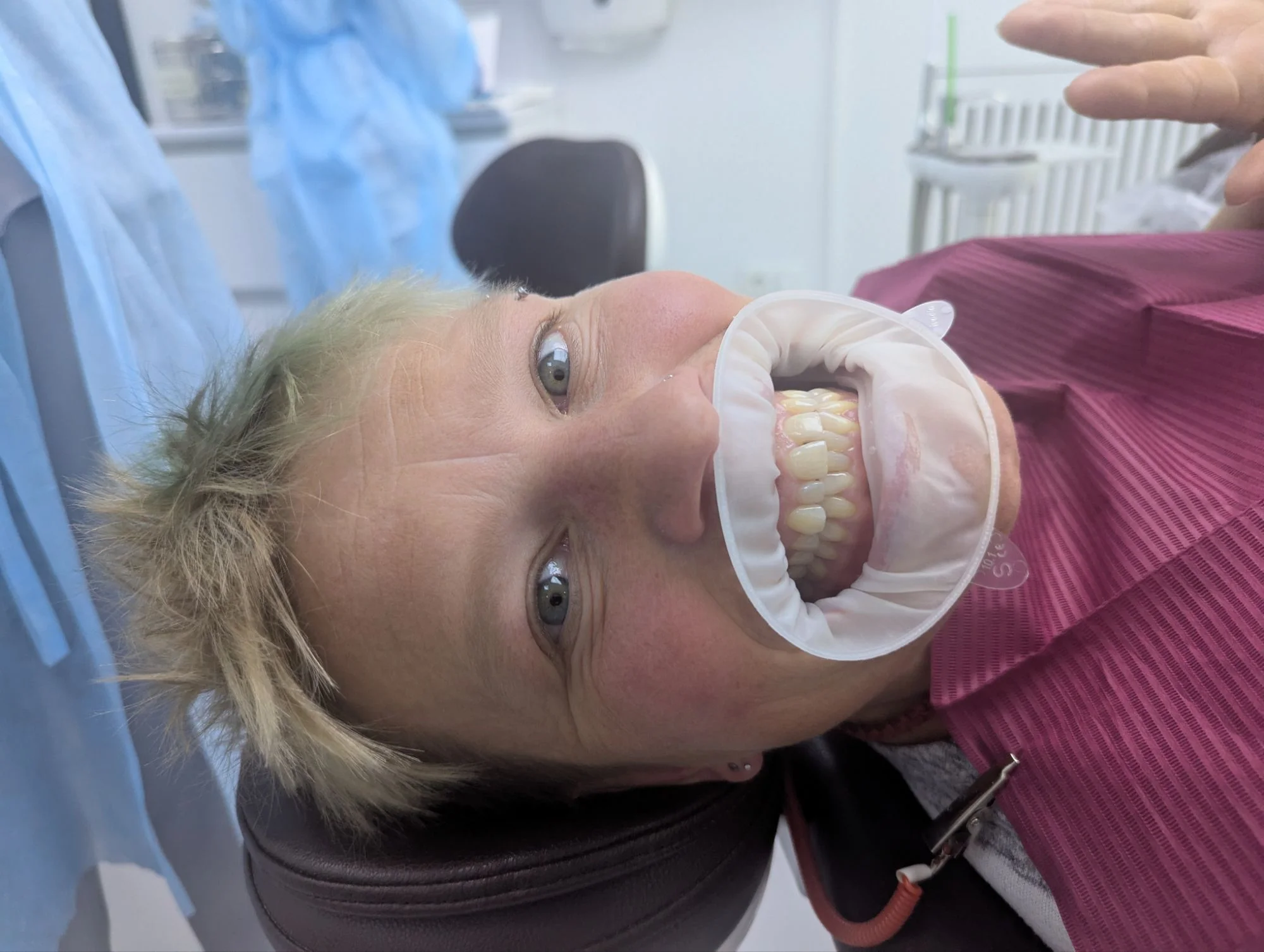 And Racki got some Hannibal Lector treatment.