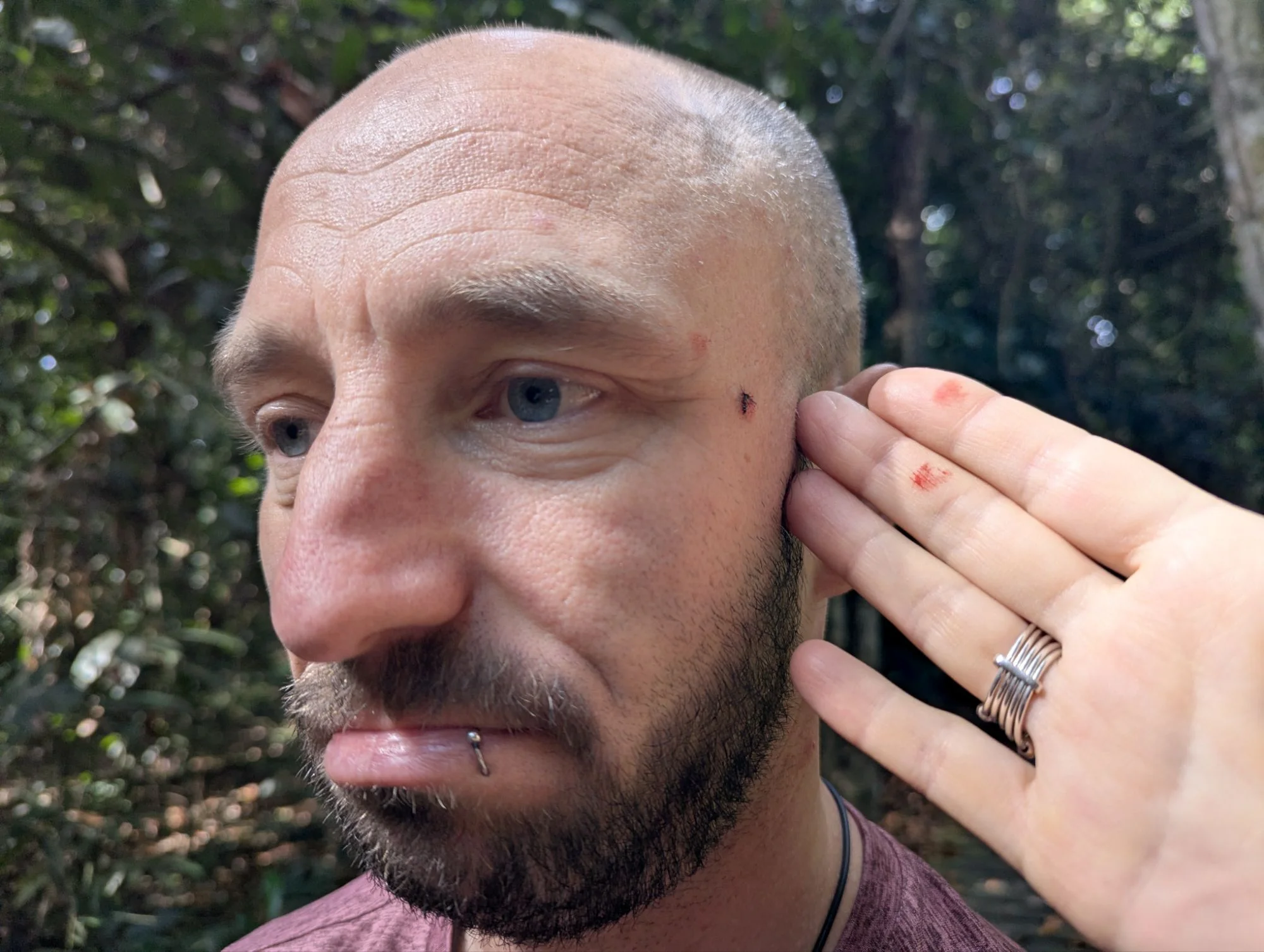 Some suckers were not our friends.